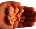 32. Pielgrzymka Obrońców Życia na Jasną Górę: „Bronić życia i umacniać je, czcić je i kochać” 
