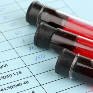 Kobiety po 50. roku życia bardziej narażone na HIV